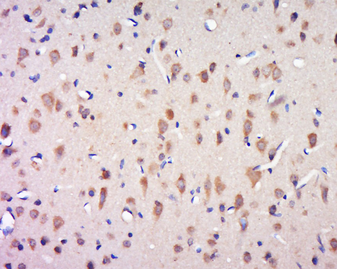 14 - CCDC124 Rabbit pAb AP58862