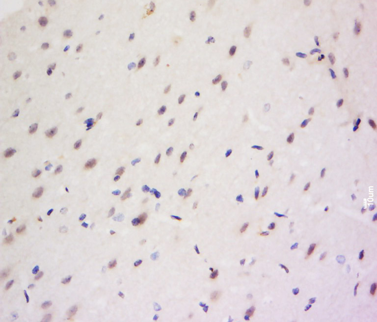 14 - CCDC82 Rabbit pAb AP58863