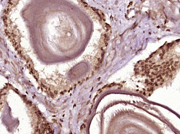 14 - CCDC30 Rabbit pAb AP58870