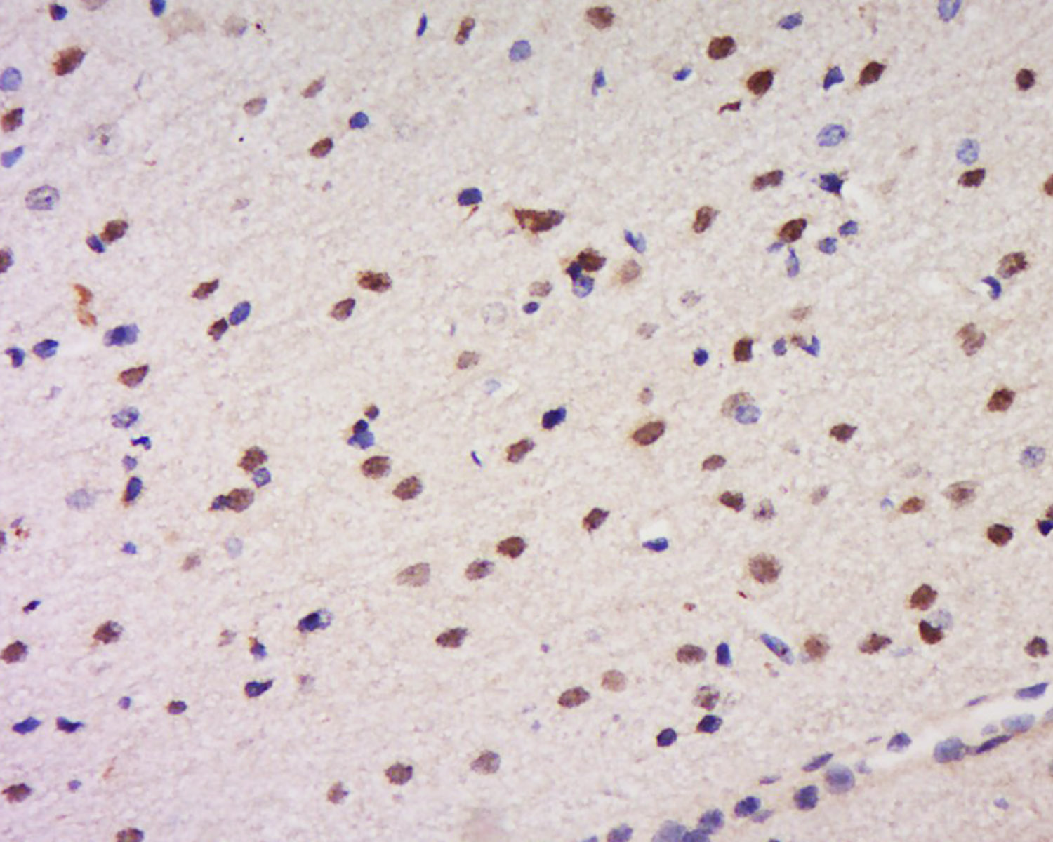 14 - CCDC34 Rabbit pAb AP58871