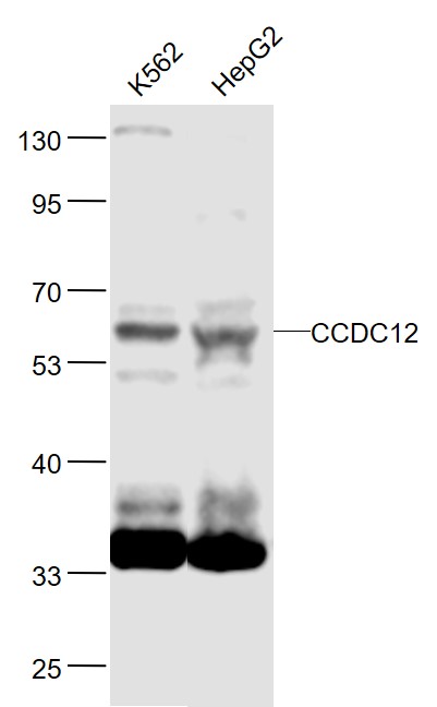 1 - CCDC12 Rabbit pAb AP58874