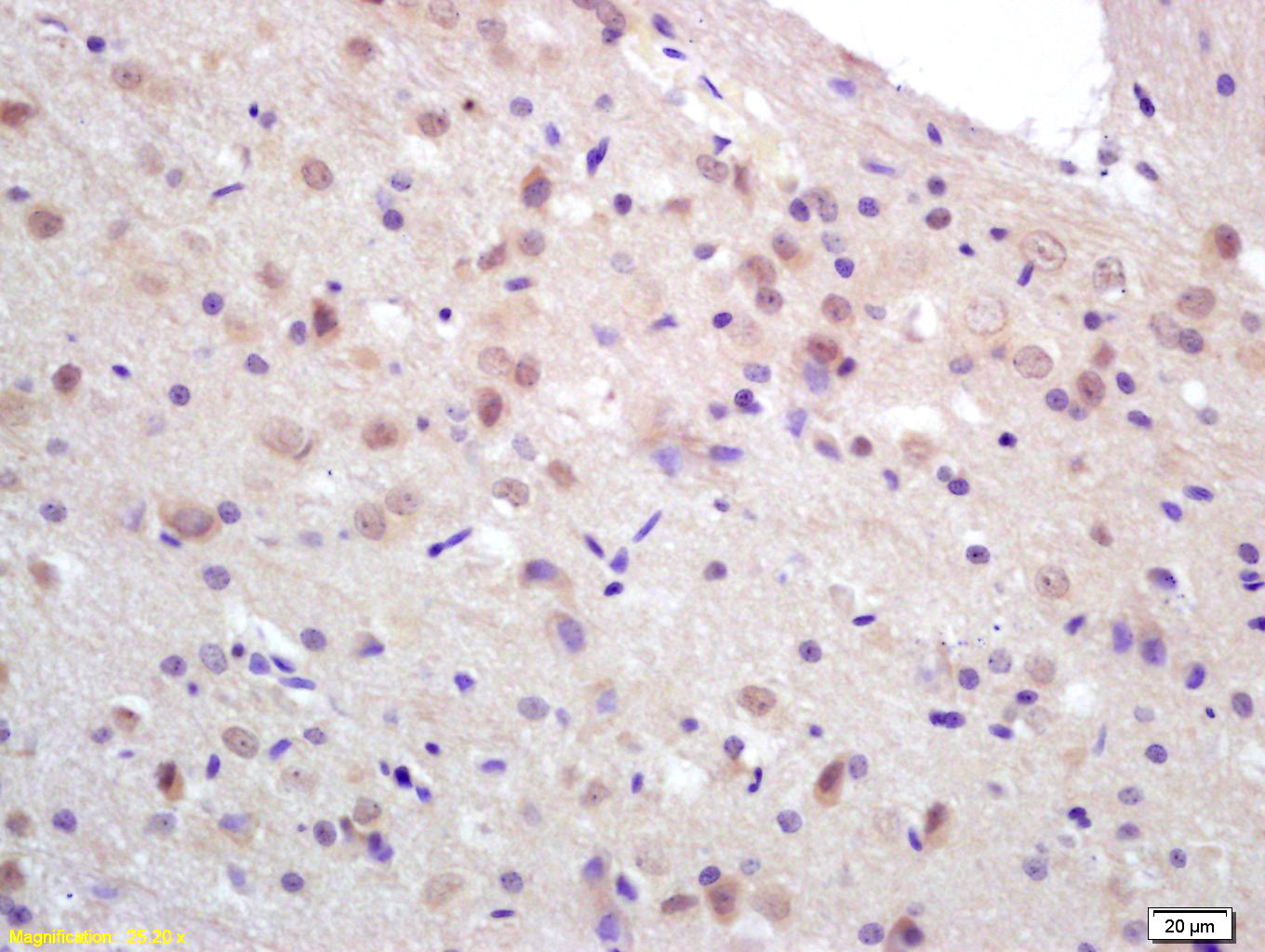 14 - CCDC12 Rabbit pAb AP58874