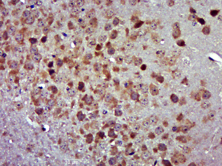 14 - CCDC67 Rabbit pAb AP58875