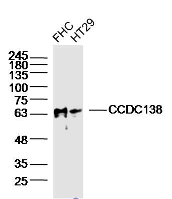 1 - CCDC138 Rabbit pAb AP58880