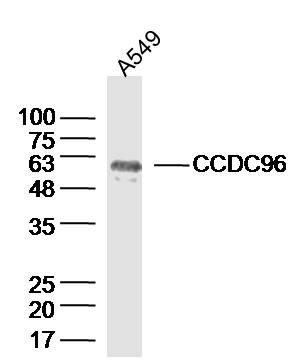 1 - CCDC96 Rabbit pAb AP58895