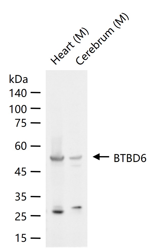 1 - BTBD6 Rabbit pAb AP58900