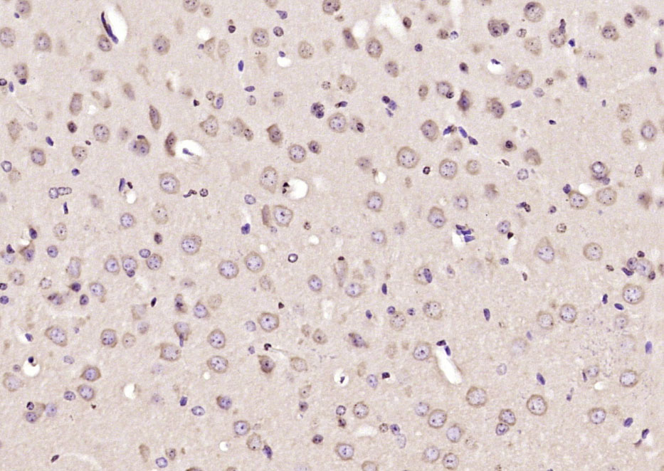 14 - COMMD10 Rabbit pAb AP58905