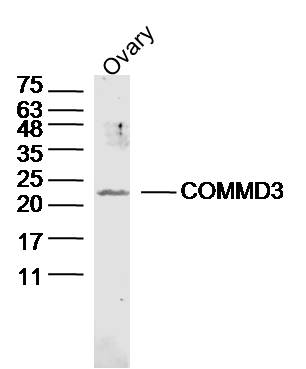 1 - COMMD3 Rabbit pAb AP58907