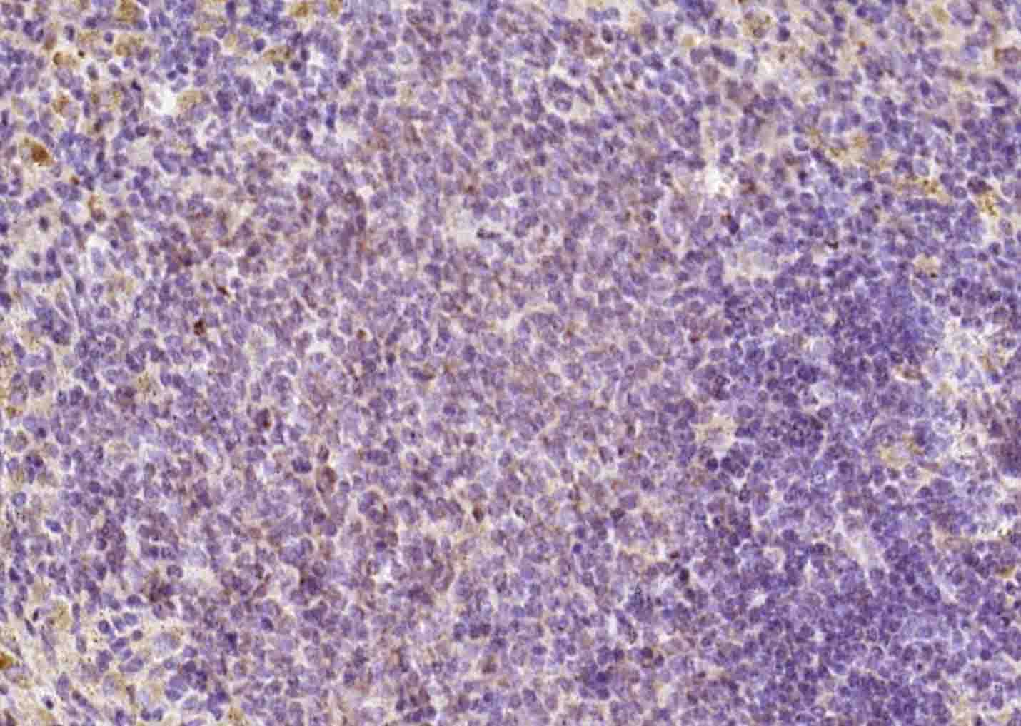 14 - FAM46C Rabbit pAb AP58914