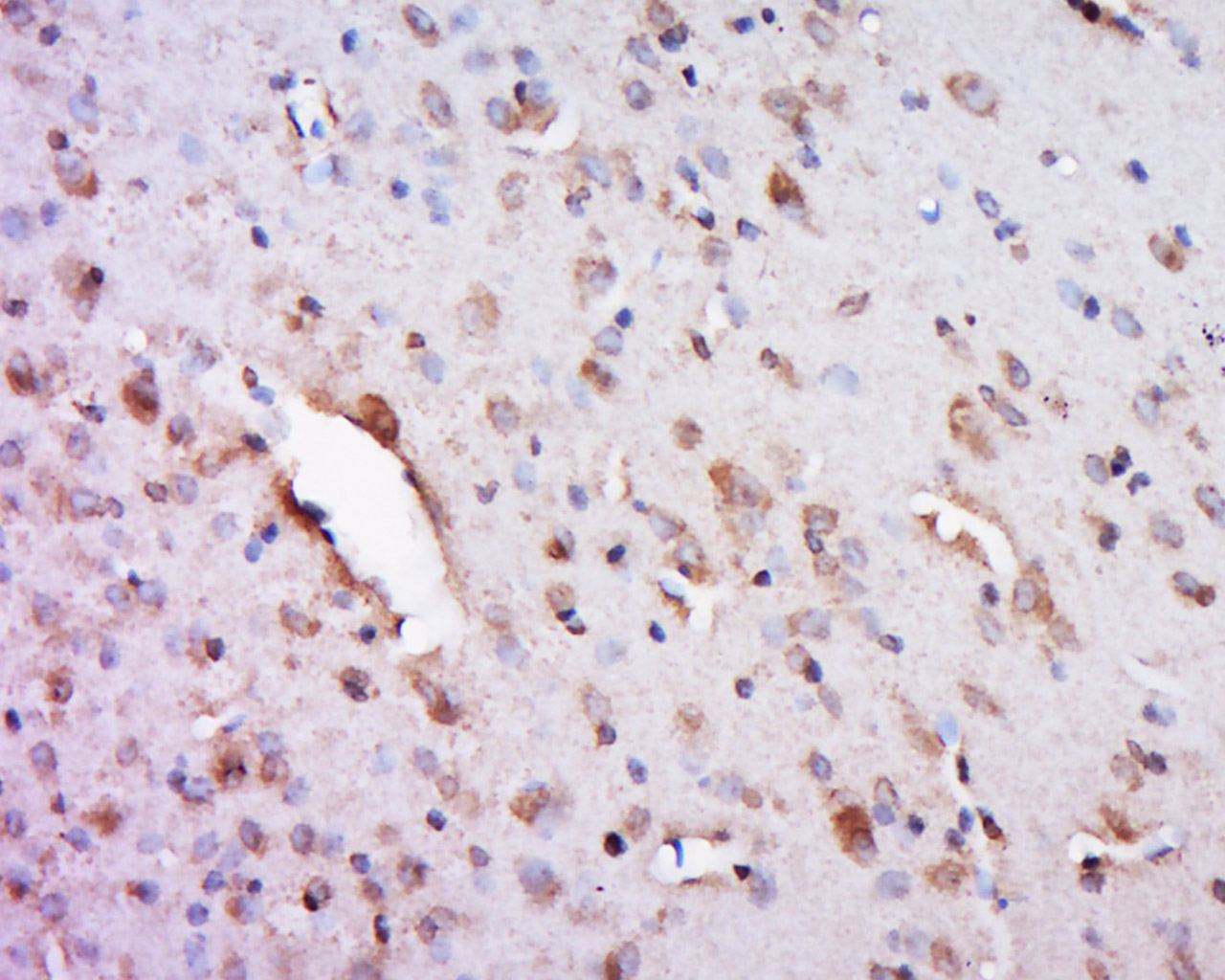 14 - FAM113A Rabbit pAb AP58918
