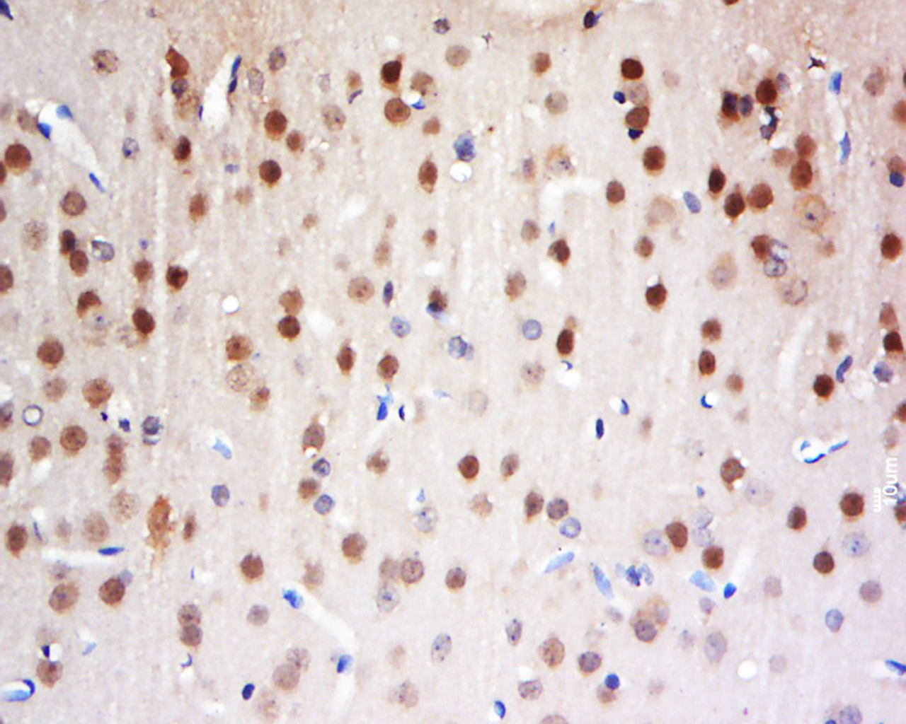 14 - FAM13C1 Rabbit pAb AP58919