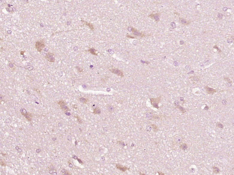 14 - FAM150A Rabbit pAb AP58922