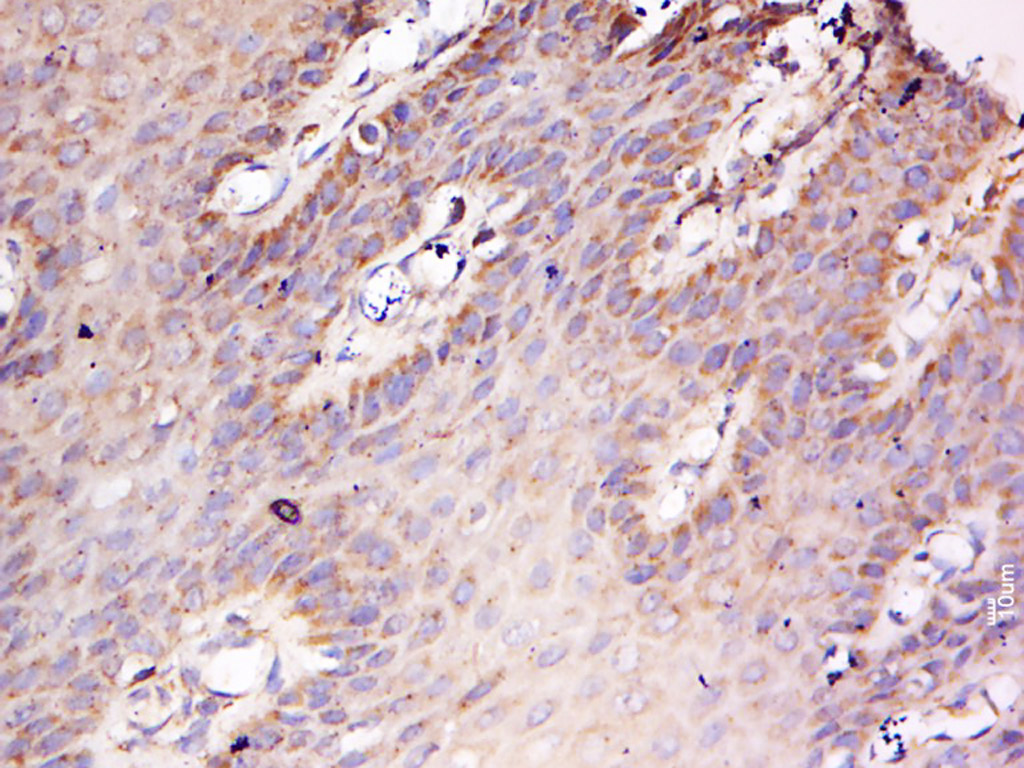 14 - FAM102B Rabbit pAb AP58930