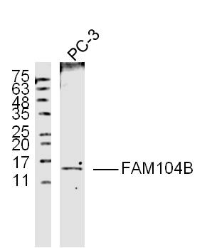 1 - FAM104B Rabbit pAb AP58931