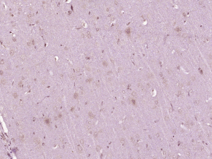 14 - FRMD4A Rabbit pAb AP58934