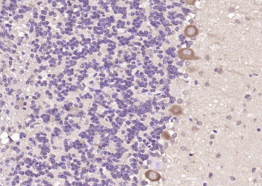 14 - FRMD4B Rabbit pAb AP58935