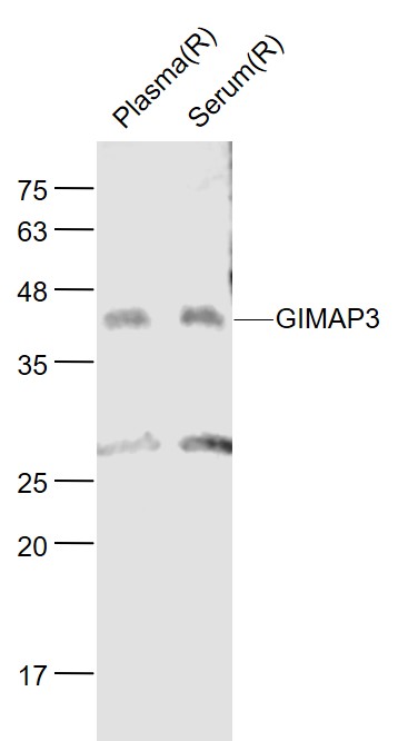 1 - GIMAP3 Rabbit pAb AP58947