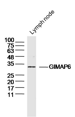 1 - GIMAP6 Rabbit pAb AP58948
