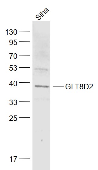 1 - GLT8D2 Rabbit pAb AP58957