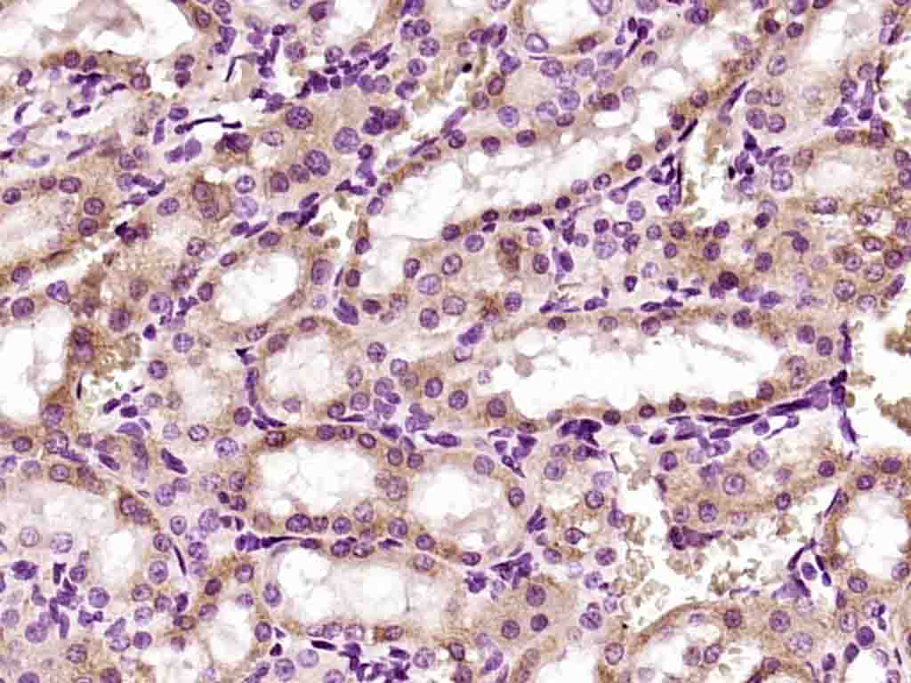 14 - PANK4 Rabbit pAb AP58970