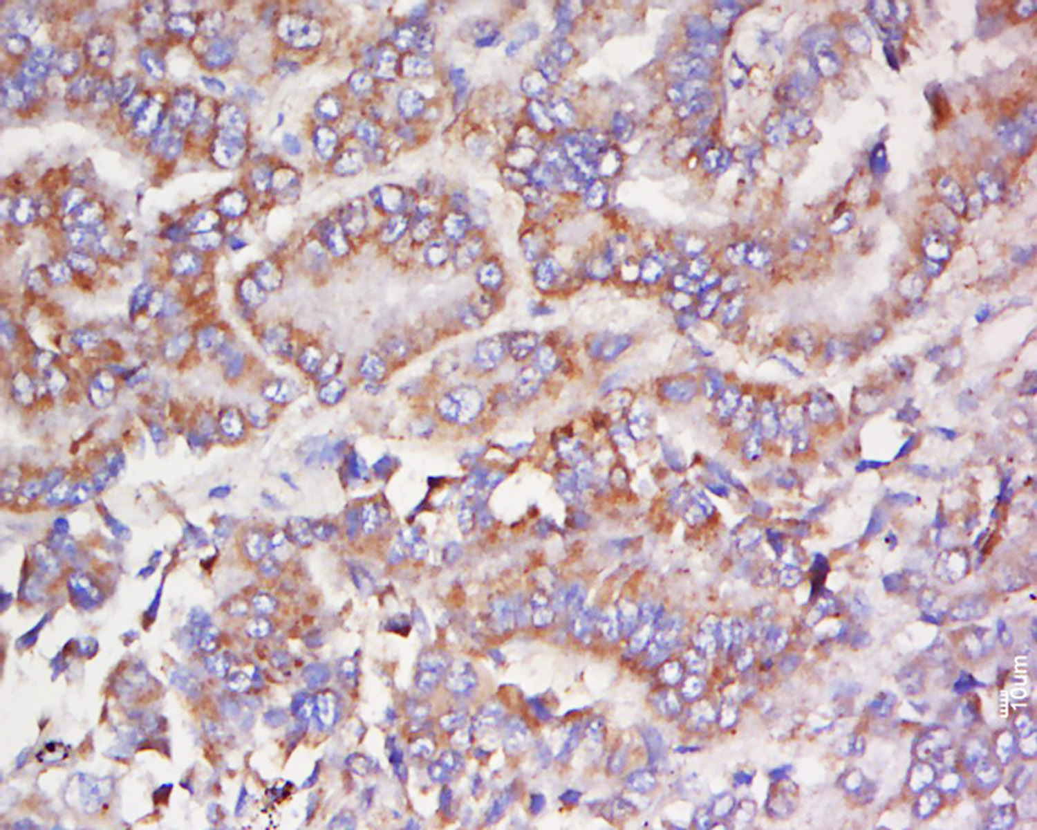 14 - FCHSD1 Rabbit pAb AP58972