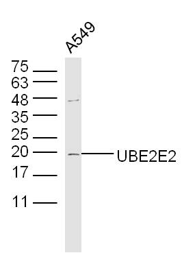 1 - UBE2E2 Rabbit pAb AP58973