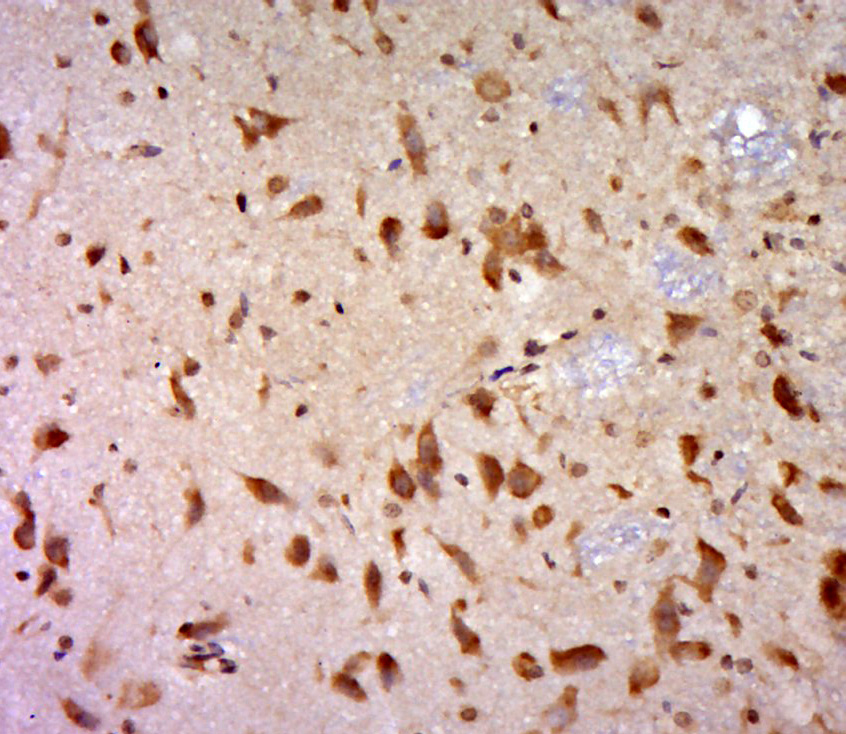 14 - UBE2E2 Rabbit pAb AP58973