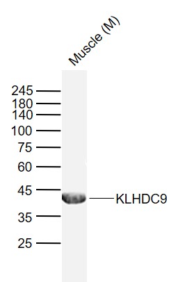 1 - KLHDC9 Rabbit pAb AP58975
