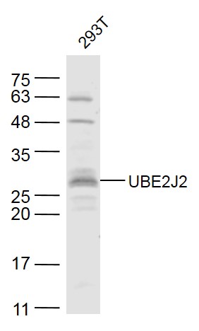 1 - UBE2J2 Rabbit pAb AP58984