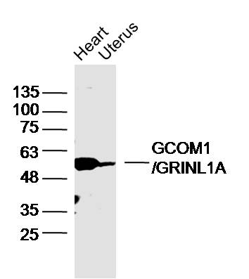 1 - GCOM1/GRINL1A Rabbit pAb AP58991