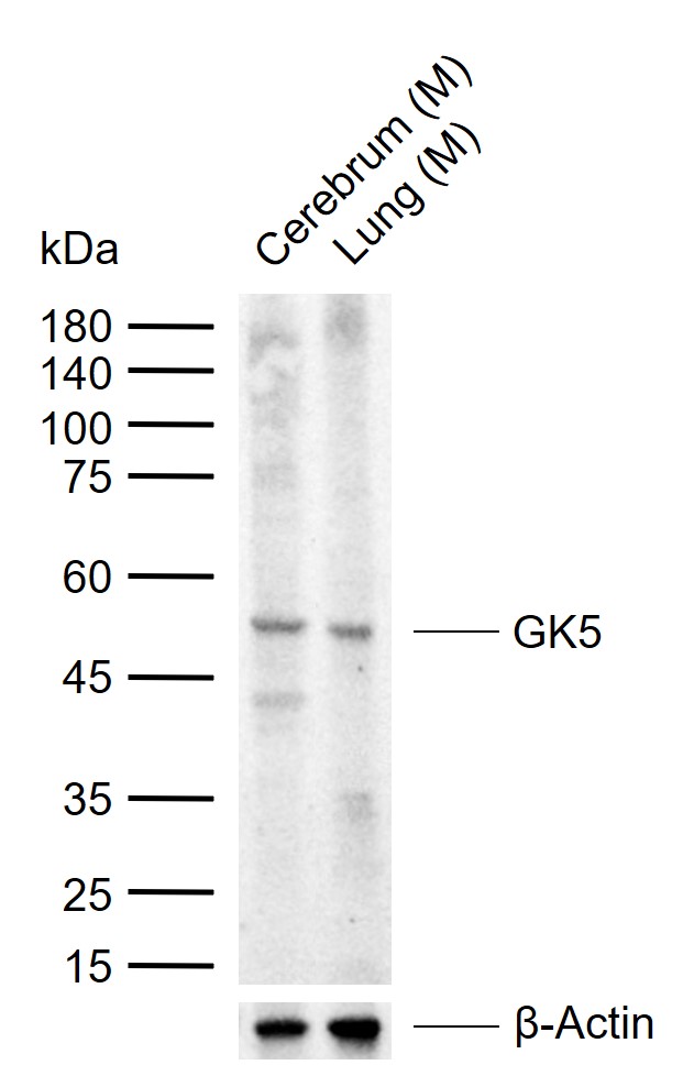 1 - GK5 Rabbit pAb AP58994