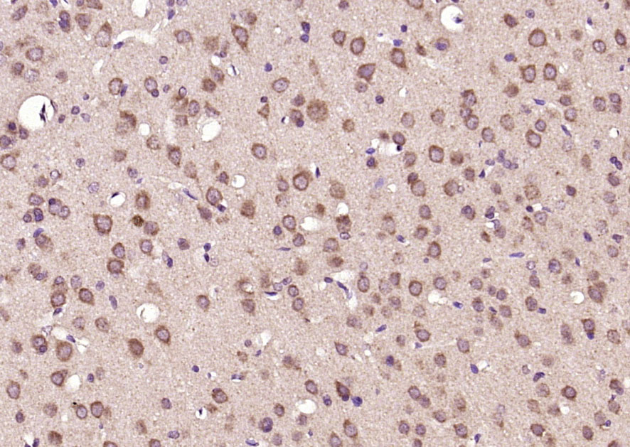 14 - GK5 Rabbit pAb AP58994
