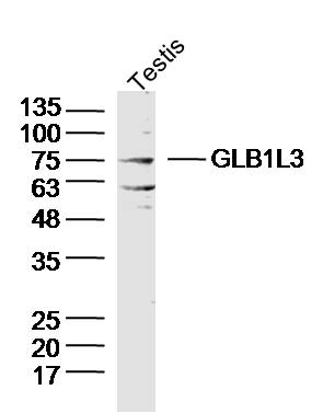1 - GLB1L3 Rabbit pAb AP58995