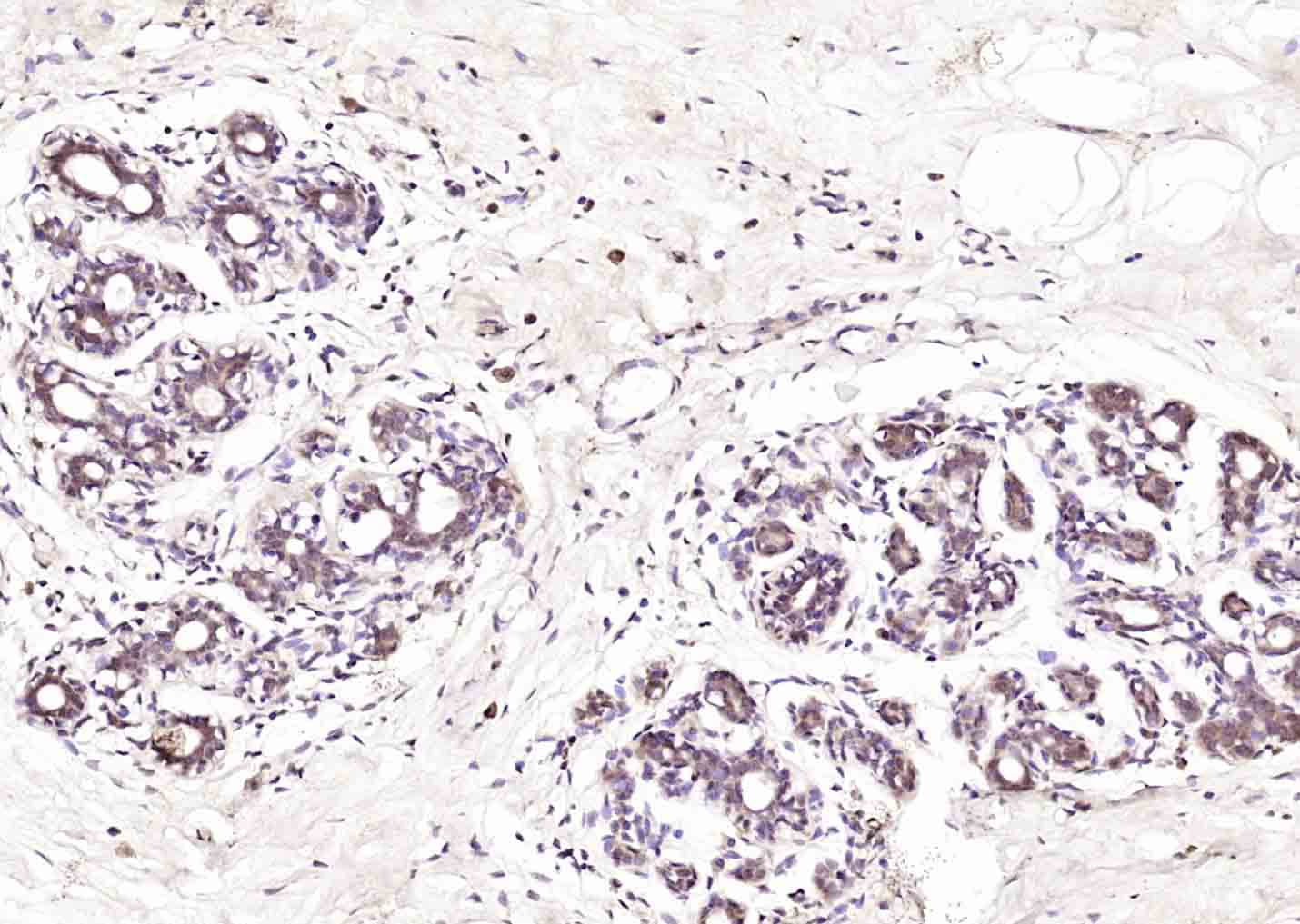 14 - Galectin 12 Rabbit pAb AP58996