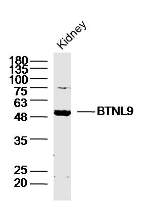 1 - BTNL9 Rabbit pAb AP59005