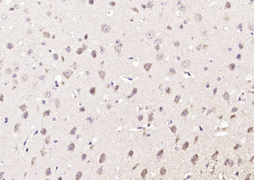 14 - ZNF804A Rabbit pAb AP59011