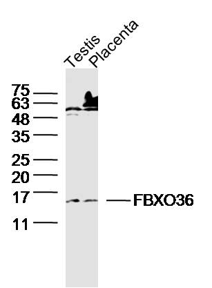 1 - FBXO36 Rabbit pAb AP59014