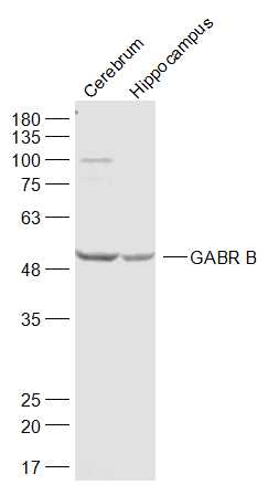1 - GABR B3 Rabbit pAb AP59032