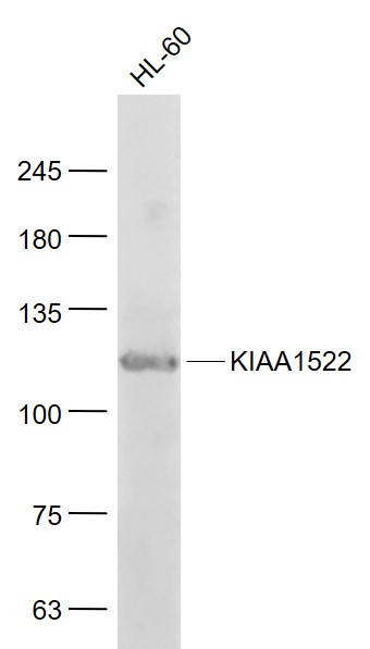 1 - KIAA1522 Rabbit pAb AP59040
