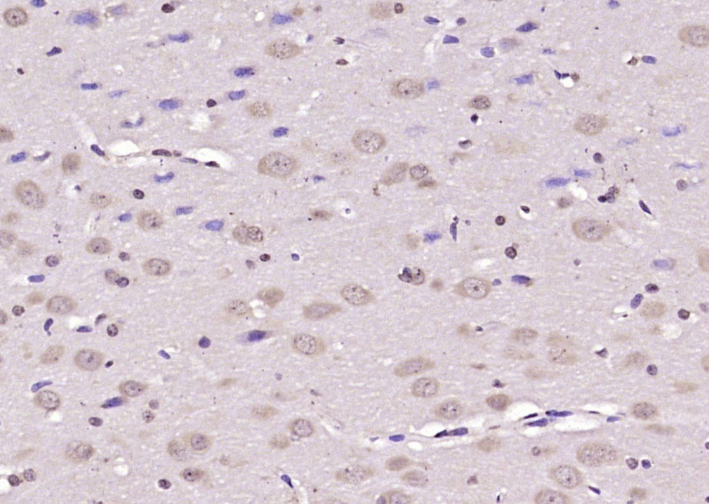14 - FSIP1 Rabbit pAb AP59041