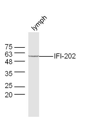 1 - IFI202 Rabbit pAb AP59060