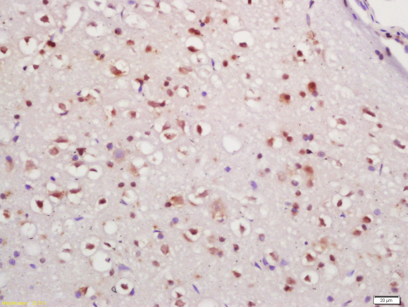 14 - IFI202 Rabbit pAb AP59060