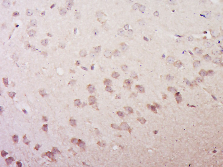 14 - VGLUT3/SLC17A8 Rabbit pAb AP59066