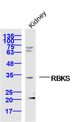 1 - RBKS Rabbit pAb AP59067