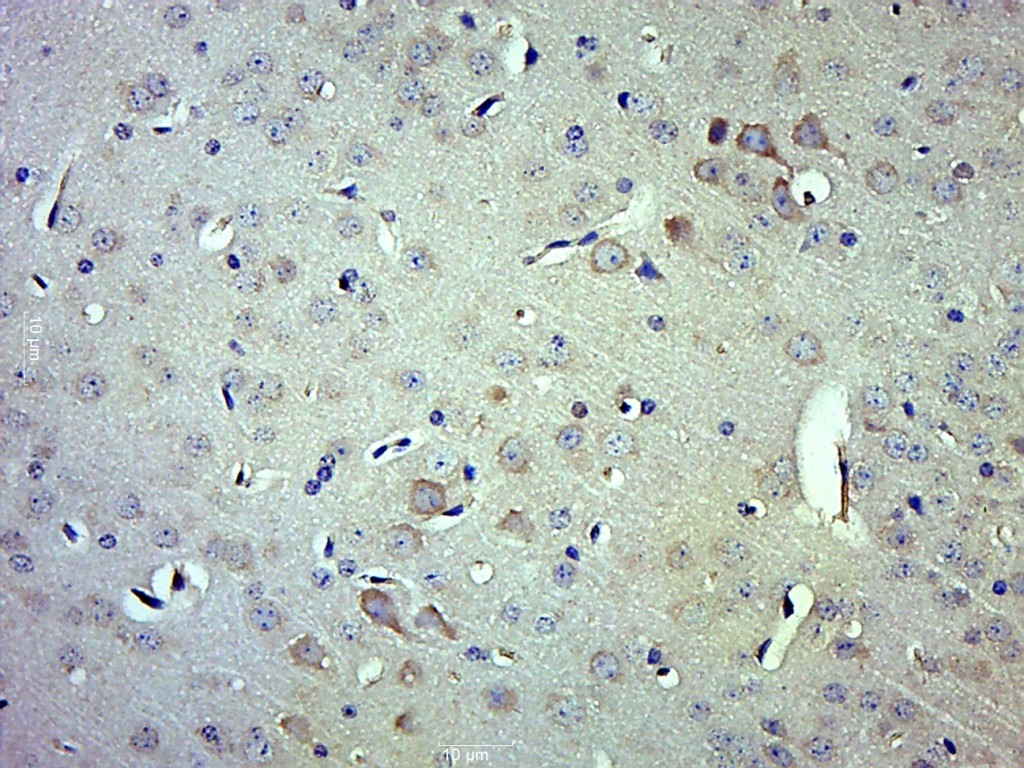 14 - ITCH/AIP4 Rabbit pAb AP59068