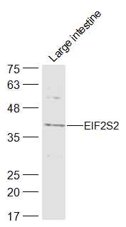 1 - EIF2S2 Rabbit pAb AP59073