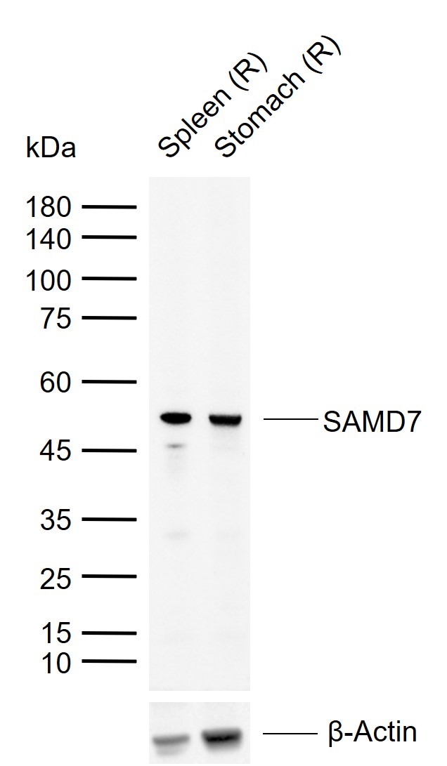 1 - SAMD7 Rabbit pAb AP59098