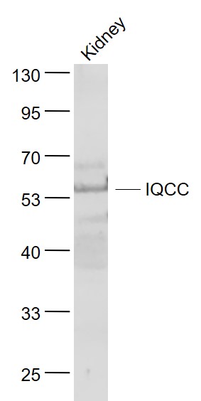 1 - IQCC Rabbit pAb AP59107
