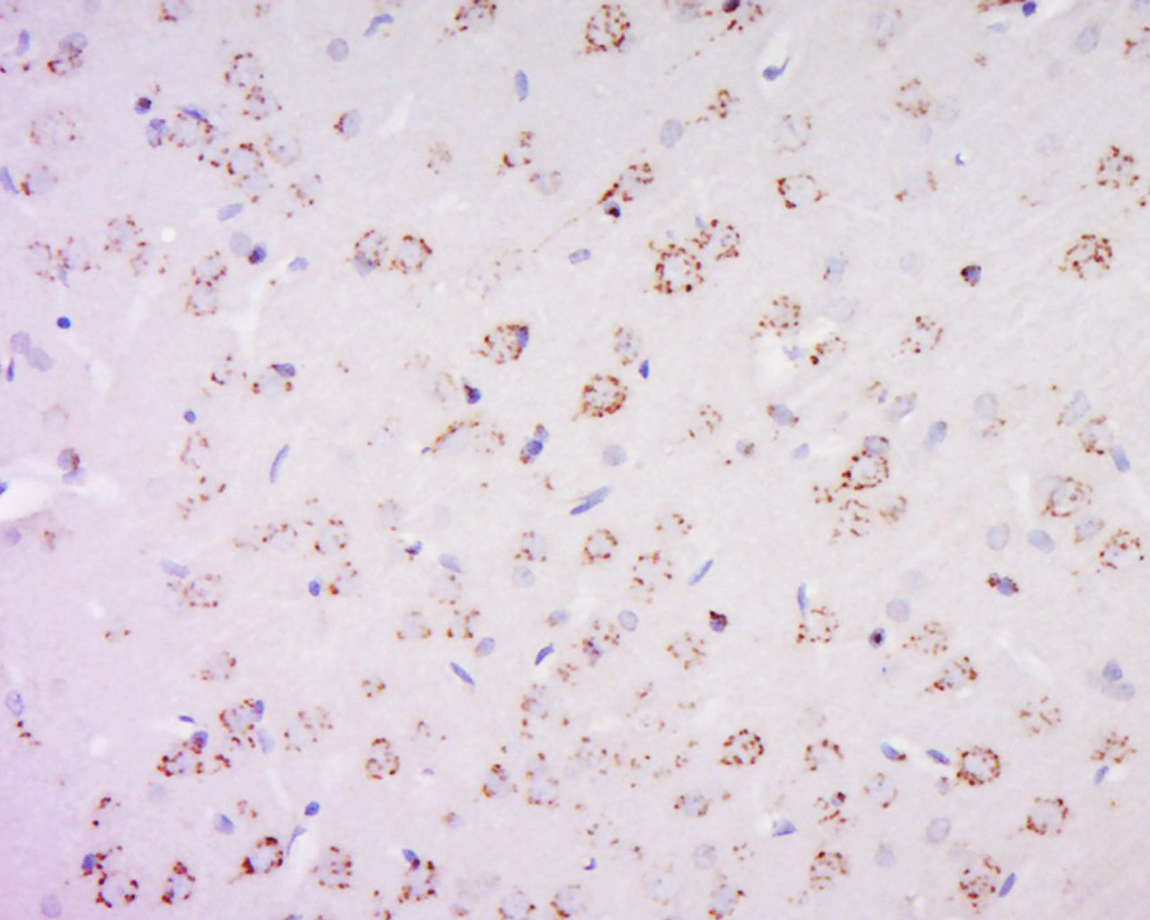 14 - PAS1C1 Rabbit pAb AP59112