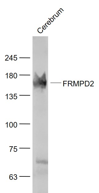 1 - FRMPD2 Rabbit pAb AP59115